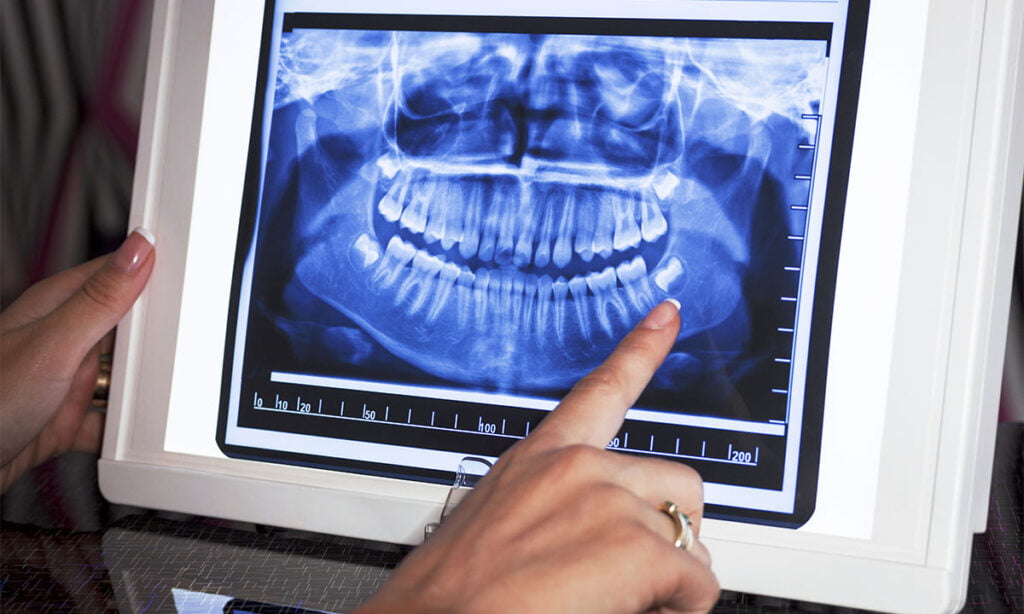 Otras Aplicaciones De Los Rayos X stonkstutors.com