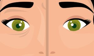 Aplicación para eliminar ojeras en las fotos fácil y rápido | Aplicación para eliminar ojeras en las fotos fácil y rápido3